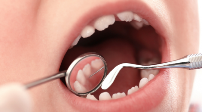 8 Reasons To Take Your Child To A Dentist in KR Puram, Bangalore