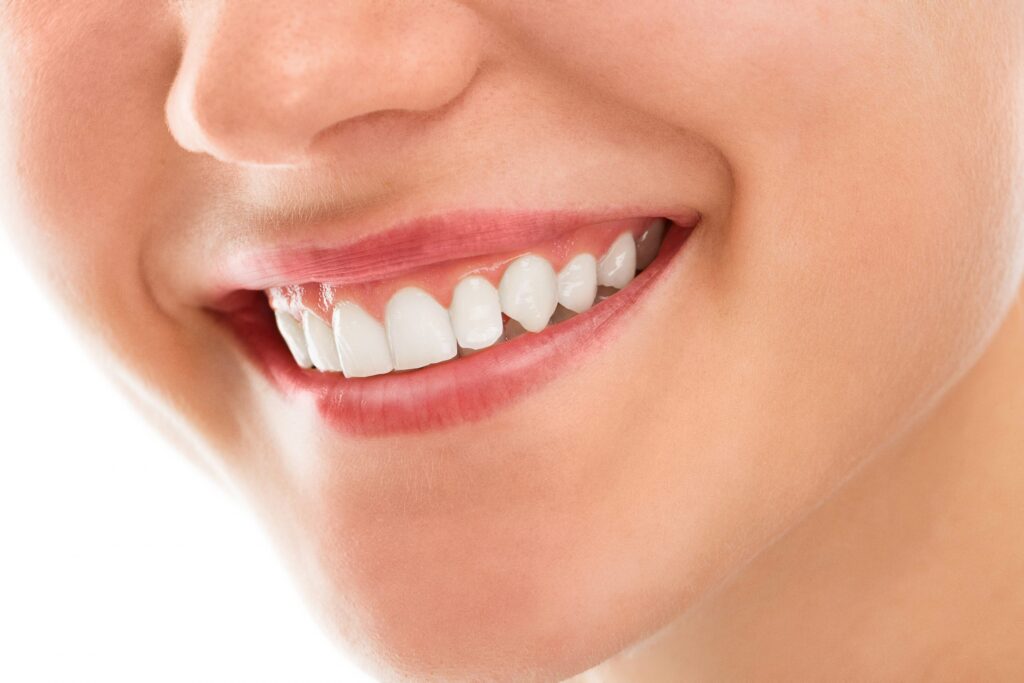 A woman is smiling while being at the dentist