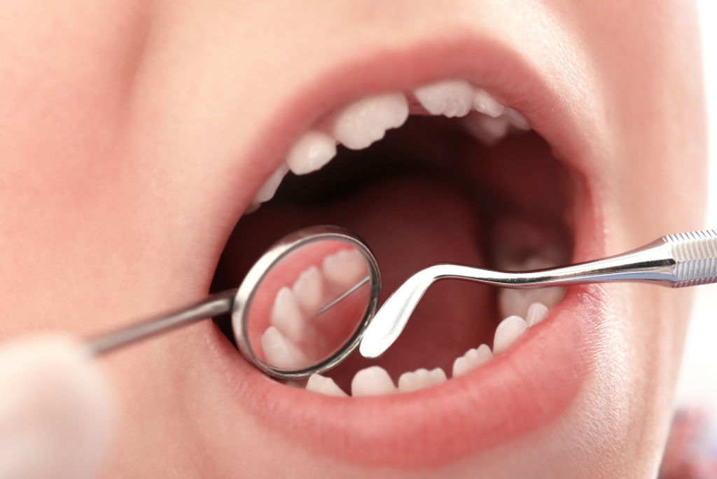 pediatric dentist in kr puram