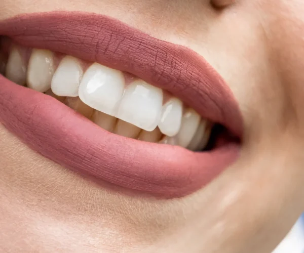 SmileMakeover_img7_1